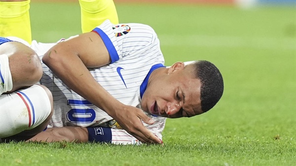 Broken nose to force France's soccer star Kylian Mbappé to wear a mask if he carries on in UEFA championship
