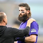 Rockies DH Blackmon leaves game vs. Padres after getting hit on left arm, left eye by errant throw