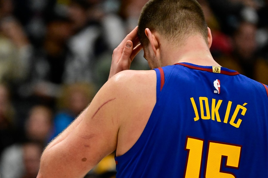 How did Nikola Jokic get all those scratches on his arms? “He gets fouled a...